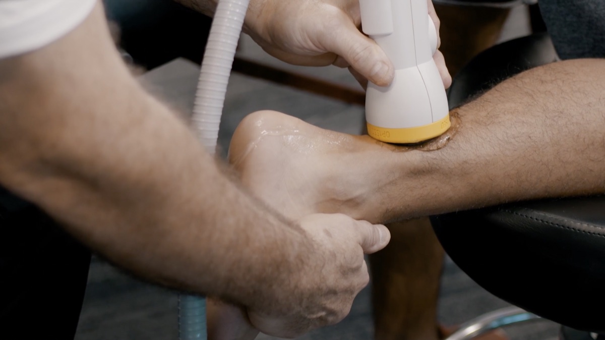 Achilles and heel being treated with shockwave therapy